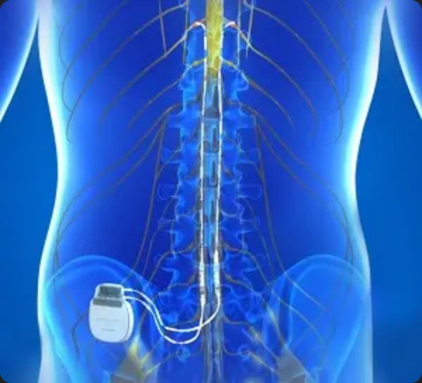 Florida Spine & Pain Center – Spine Pain Management in Broward County 174 Spine pain management in Broward County